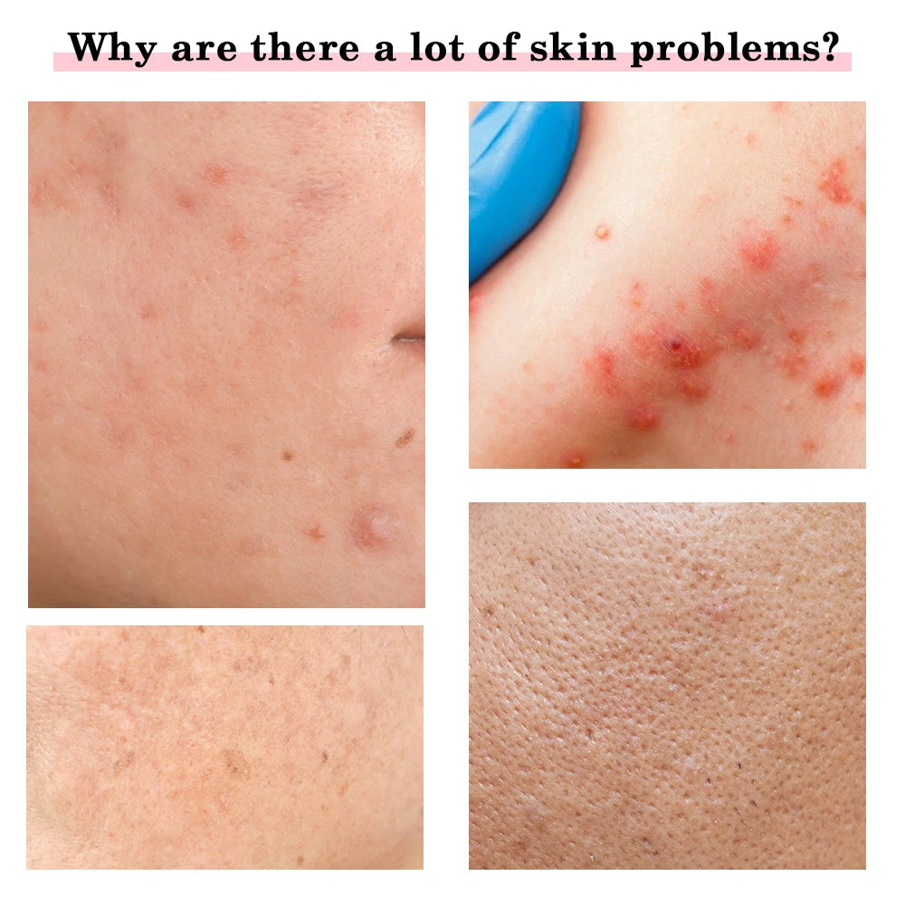 EMS Micro Current Lifting Device Vibration LED Face Skin Rejuvenation Wrinkle Remover Anti-Aging Facial Beauty Device